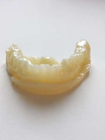 dentier-banane3